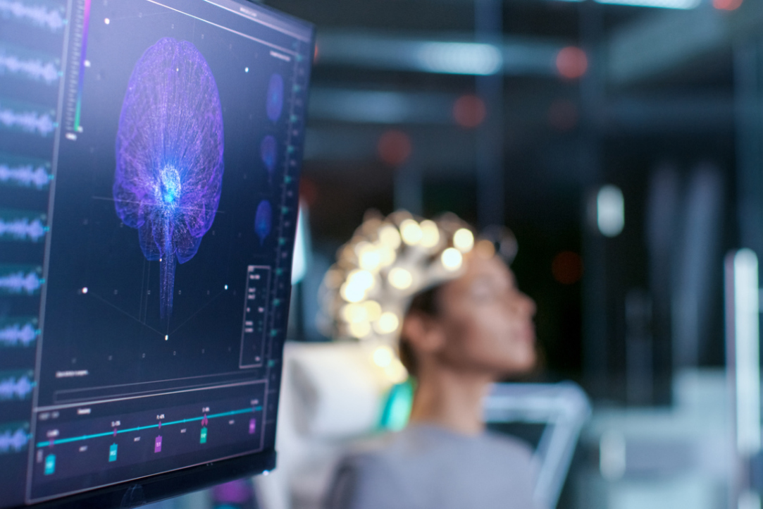 Illustration for news: Machine Learning Predicts Epileptogenic Activity from High-Frequency Oscillation Rates