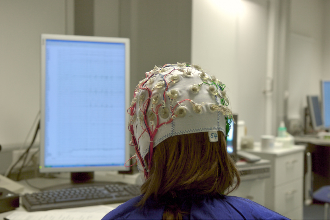 Electrical Brain Stimulation Helps Memorise New Words Illustration for news: Electrical Brain Stimulation Helps Memorise New Words